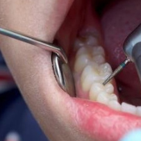 延安牙衛(wèi)士口腔門(mén)診部