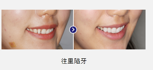 韓國(guó)今日安MINISH牙科醫(yī)院