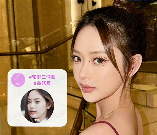 韓國id整形醫(yī)院