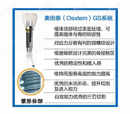 奧齒泰GS系統(tǒng)