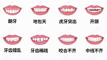 牙齒不齊.jpg