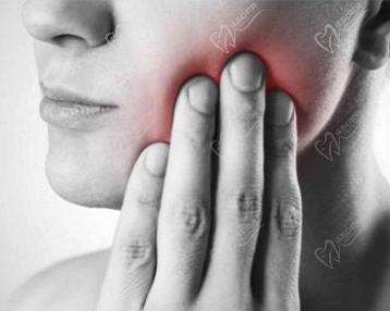 牙髓炎引發(fā)間歇性牙疼