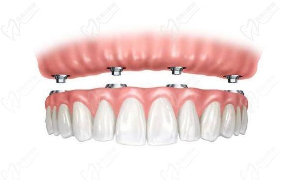 方道昕 九江濂溪諾一口腔門診部 種植醫(yī)師