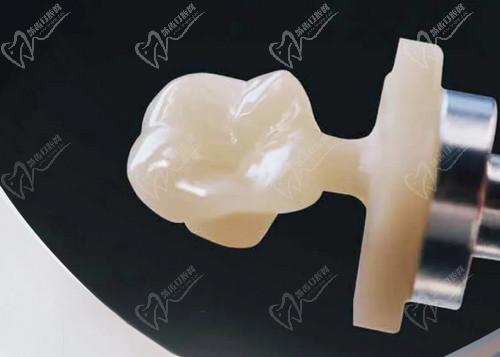 愛爾創(chuàng)全瓷牙價格