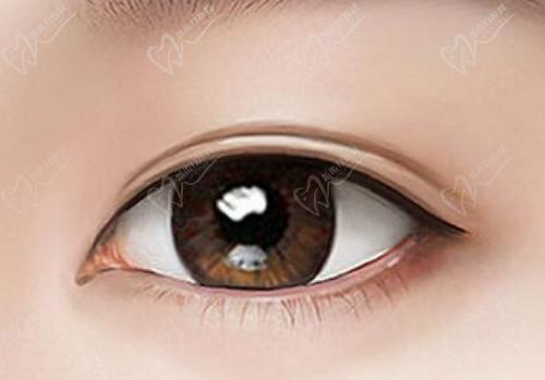 武漢同 濟(jì)唐泓波醫(yī)生做眼整形技術(shù)高超