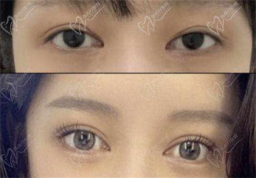 五、南京美萊王小林醫(yī)生患者評(píng)價(jià)與反饋