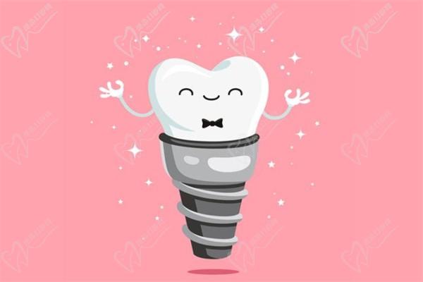 做完種植牙后，種植牙術(shù)后種日常生活護(hù)理方法4點(diǎn)建議！