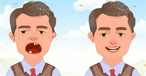 別等了！徐州邳州牙衛(wèi)士口腔進(jìn)口種植牙2980起,種兩顆送一顆,單顆滿(mǎn)3000減500超劃算！